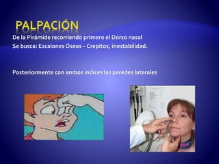 De la Pirámide recorriendo primero el Dorso nasal
Se busca: Escalones Óseos – Crepitos, inestabilidad.
Posteriormente con ambos índices las paredes laterales
 