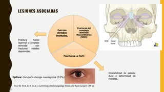 LESIONES ASOCIADAS
Paul W. Flint, B. H. (n.d.). Cummings Otolaryngology Head and Neck Surgery 7th ed.
Fracturas del
complejo
etmoidal
Nasoorbitarias
(NOE):
Fracturas Le fort:
fuerzas
directas
frontales.
Fractura hueso
lagrimal y complejo
etmoidal con
fracturas nasales
deprimidas.
Ensanchamiento de
distancia intercantal
por desprendimiento
de tendón cantal
medial.
Inestabilidad de paladar
duro y deformidad de
mordida.
Epifora: disrupción drenaje nasolagrimal (0.2%).
12
 