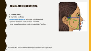 EVALUACIÓN DIAGNÓSTICA
• Examen físico:
El diagnóstico es clínico.
-Desviación y asimetría: deformidad traumática aguda.
-Epistaxis, inflamación nasal, equimosis periorbital.
-Tomar fotografías de cabeza en plano horizontal de Frankfurt.
Paul W. Flint, B. H. (n.d.). Cummings Otolaryngology Head and Neck Surgery 7th ed.
16
 