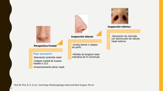 Mejor apreciación:
-Desviación pirámide nasal
-Colapso medial de huesos
nasales o CLS.
-Ensanchamiento dorso nasal.
-Joroba lateral o colapso
de perfil.
-Pérdida de longitud nasal
indicativa de fx conminuta
-Desviación de columela
con disminución de válvula
nasal externa.
Paul W. Flint, B. H. (n.d.). Cummings Otolaryngology Head and Neck Surgery 7th ed.
Perspectiva frontal
Inspección lateral:
Inspección inferior:
17
 