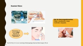 Examen físico:
Uso de descongestionantes.
-Mejor visualización mejor.
-Controlar sangrado.
Reexaminar al
px en 3 días
después de
disminución de
inflamación.
Paul W. Flint, B. H. (n.d.). Cummings Otolaryngology Head and Neck Surgery 7th ed.
19
 