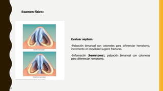 Evaluar septum.
-Palpación bimanual con cotonetes para diferenciar hematoma,
incremento en movilidad sugiere fracturas.
-Inflamación (hematoma), palpación bimanual con cotonetes
para diferenciar hematoma.
Examen físico:
20
 