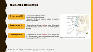 EVALUACIÓN DIAGNÓSTICA
Brown-gruss III-
Brown-gruss II-
Brown-gruss I-
-Compresión de bóveda inferior.
-Hiperrotación de punta nasal.
-Disrupción de ángulo septal o colapso en septum
caudal fragmentado.
-Compresión de bóveda media produce deformidad
en silla de montar cuando porción central de septum
se daña.
-Compresión de bóveda superior causa colapso de
1/3 superior de la nariz con conminución de huesos
nasales y proceso frontal maxilar
Paul W. Flint, B. H. (n.d.). Cummings Otolaryngology Head and Neck Surgery 7th ed.
22
 