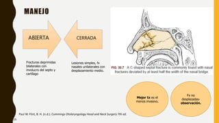 MANEJO
Fracturas deprimidas
bilaterales con
involucro del septo y
cartílago
Paul W. Flint, B. H. (n.d.). Cummings Otolaryngology Head and Neck Surgery 7th ed.
ABIERTA CERRADA
Lesiones simples, fx
nasales unilaterales con
desplazamiento medio.
Mejor tx es el
menos invasivo.
Fx no
desplazadas-
observación.
29
 