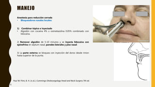 MANEJO
Paul W. Flint, B. H. (n.d.). Cummings Otolaryngology Head and Neck Surgery 7th ed.
Anestesia para reducción cerrada
• Bloqueadores nasales locales:
1) Combinar tópico e inyectado
• Algodón con cocaína 4% u oximetazolina 0.05% combinado con
lidocaína.
2) Remover algodón de 5-10 minutos y se inyecta lidocaína con
epinefrina en septum nasal, paredes laterales y piso nasal.
3) La parte externa se bloquea con inyección del dorso desde rinion
hasta superior de la punta.
31
 