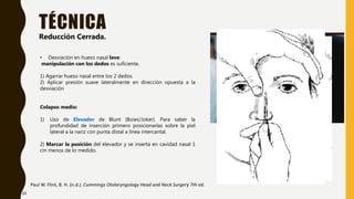 TÉCNICA
Paul W. Flint, B. H. (n.d.). Cummings Otolaryngology Head and Neck Surgery 7th ed.
Reducción Cerrada.
• Desviación en hueso nasal leve:
manipulación con los dedos es suficiente.
1) Agarrar hueso nasal entre los 2 dedos.
2) Aplicar presión suave lateralmente en dirección opuesta a la
desviación
Colapso medio:
1) Uso de Elevador de Blunt (Boies/Joker). Para saber la
profundidad de inserción primero posicionarlas sobre la piel
lateral a la nariz con punta distal a línea intercantal.
2) Marcar la posición del elevador y se inserta en cavidad nasal 1
cm menos de lo medido.
34
 