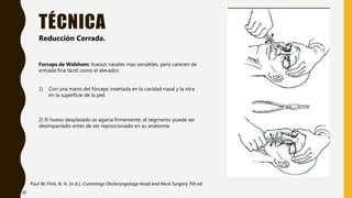 TÉCNICA
Paul W. Flint, B. H. (n.d.). Cummings Otolaryngology Head and Neck Surgery 7th ed.
Reducción Cerrada.
Forceps de Walsham: huesos nasales mas versátiles, pero carecen de
entrada fina táctil como el elevador.
1) Con una mano del fórceps insertada en la cavidad nasal y la otra
en la superficie de la piel.
2) El hueso desplazado se agarra firmemente, el segmento puede ser
desimpactado antes de ser reposicionado en su anatomía
36
 