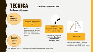 TÉCNICA
Paul W. Flint, B. H. (n.d.). Cummings Otolaryngology Head and Neck Surgery 7th ed.
Reducción Cerrada.
LESIONES CARTILAGINOSAS.
Avulsión medial de
CLS
Falta de
conocimiento o está
fuera de tiempo.
Tallo verde.
Posible si se realiza
inmediatamente después
de la lesión seguido de 14
días con taponamiento
interno. Después de tiempo de
reducción: Desviación
persistente de
complejo nasal
externo. Persiste la desviación a pesar de
reducción en tiempo y forma
habiéndose descartado lesión septal.
2 semanas
después se
prefiere
abordaje
abierto.
Difícil
corregir con
esta técnica.
38
 