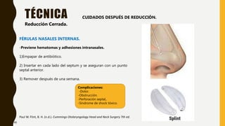 TÉCNICA
Paul W. Flint, B. H. (n.d.). Cummings Otolaryngology Head and Neck Surgery 7th ed.
Reducción Cerrada.
FÉRULAS NASALES INTERNAS.
-Previene hematomas y adhesiones intranasales.
1)Empapar de antibiótico.
2) Insertar en cada lado del septum y se aseguran con un punto
septal anterior.
3) Remover después de una semana.
Complicaciones:
-Dolor.
-Obstrucción.
-Perforación septal,.
-Síndrome de shock tóxico.
CUIDADOS DESPUÉS DE REDUCCIÓN.
40
 