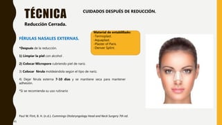 TÉCNICA
Paul W. Flint, B. H. (n.d.). Cummings Otolaryngology Head and Neck Surgery 7th ed.
Reducción Cerrada.
FÉRULAS NASALES EXTERNAS.
*Después de la reducción.
1) Limpiar la piel con alcohol .
2) Colocar Micropore cubriendo piel de nariz.
3) Colocar férula moldeándola según el tipo de nariz.
4) Dejar férula externa 7-10 días y se mantiene seca para mantener
adhesión.
*Si se recomienda su uso rutinario
CUIDADOS DESPUÉS DE REDUCCIÓN.
Material de entablillado:
-Termoplast.
-Aquaplast.
-Plaster of Paris.
-Denver Splint.
41
 