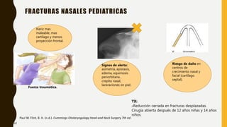 FRACTURAS NASALES PEDIATRICAS
Paul W. Flint, B. H. (n.d.). Cummings Otolaryngology Head and Neck Surgery 7th ed.
Nariz mas
maleable, mas
cartílago y menos
proyección frontal.
Riesgo de daño en
centros de
crecimiento nasal y
facial (cartílago
septal).
Fuerza traumática.
Signos de alerta:
asimetría, epistaxis,
edema, equimosis
periorbitaria ,
crepito nasal,
laceraciones en piel.
TX:
-Reducción cerrada en fracturas desplazadas.
Cirugía abierta después de 12 años niñas y 14 años
niños.
47
 