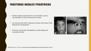 FRACTURAS NASALES PEDIATRICAS
Paul W. Flint, B. H. (n.d.). Cummings Otolaryngology Head and Neck Surgery 7th ed.
• Férulas nasales postraducción son incómodas, solo se
recomiendan en niños menores de 6 meses.
• Uso de goma de silicón nasal para colocar stent hasta 5 días
después de manipulación.
• Fracturas conminutas: Rinoplastía (no daña debajo de
mucopericondrio).
48
 