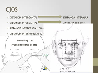 Fracturas naso-orbito-etmoidal [Autoguardado].pptx