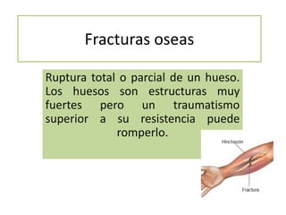 Fracturas oseas
Ruptura total o parcial de un hueso.
Los huesos son estructuras muy
fuertes pero un traumatismo
superior a su resistencia puede
romperlo.

 