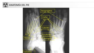 ANATOMÍA DEL PIE
Calcaneo
Astragalo
Escafoides
Cuboides
Cuñas
Sesamoideos
Metas
 