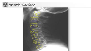 ANATOMÍA RADIOLÓGICA
C2
 