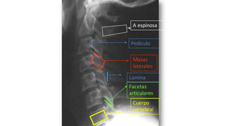 Cuerpo
vertebral
Masas
laterales
Facetas
articulares
Lamina
Pedículo
A espinosa
 