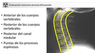 Evaluación columna cervical:Alineación
• Anterior de los cuerpos
vertebrales
• Posterior de los cuerpos
vertebrales
• Posterior del canal
medular
• Puntas de los procesos
espinosos
C1
C2
C3
C4
C7
C6
C5
 