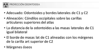 PROYECCIÓN ODONTOIDEA
• Adecuado: Odontoides y bordes laterales de C1 y C2
• Alineación: Cóndilos occipitales sobre las carillas
articulares superiores del atlas
• La distancia de la odontoides a las masas laterales de C1
igual bilateral
• El borde de masas lat de C1 alineadas con los márgenes
de la carilla art superior de C2
• Márgenes óseos
 