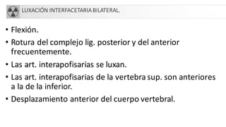 LUXACIÓN INTERFACETARIABILATERAL.
• Flexión.
• Rotura del complejo lig. posterior y del anterior
frecuentemente.
• Las art. interapofisarias se luxan.
• Las art. interapofisarias de la vertebra sup. son anteriores
a la de la inferior.
• Desplazamiento anterior del cuerpo vertebral.
 
