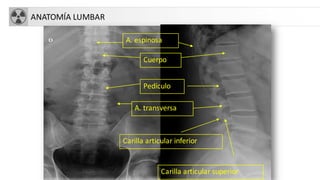 ANATOMÍA LUMBAR
Cuerpo
Pedículo
A. transversa
Carilla articular inferior
Carilla articular superior
A. espinosa
 