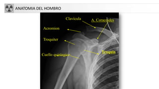 ANATOMIA DEL HOMBRO
Cuello quirúrgico
Troquiter
Troquín
Acromion
Clavícula A. Coracoides
 