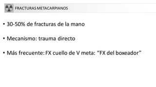 FRACTURASMETACARPIANOS
• 30-50% de fracturas de la mano
• Mecanismo: trauma directo
• Más frecuente:FX cuello de V meta: “FX del boxeador”
 