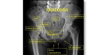 Ileon Sacro
Rama
iliopubiana
Rama
isquiopubiana
Acetabulo
A. obturador
Cabeza femoral
Sínfisis púbica
Art. sacroiliaca
ANATOMÍA
 