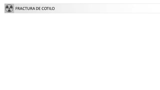 FRACTURA DE COTILO
 
