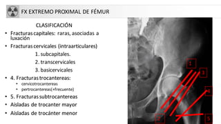 FX EXTREMO PROXIMAL DE FÉMUR
CLASIFICACIÓN
• Fracturascapitales: raras, asociadas a
luxación
• Fracturascervicales (intraarticulares)
1. subcapitales.
2. transcervicales
3. basicervicales
• 4. Fracturastrocantereas:
• cervicotrocantereas
• pertrocantereas(+frecuente)
• 5. Fracturassubtrocantereas
• Aisladas de trocanter mayor
• Aisladas de trocánter menor
1
2
3
4
5
 