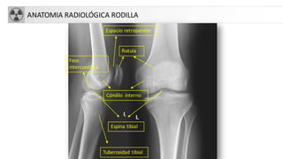 ANATOMIA RADIOLÓGICA RODILLA
Rotula
Espacio retropatelar
Cóndilo interno
Fosa
intercondilea
Espina tibial
Tuberosidad tibial
 