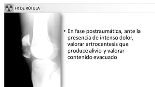 FX DE RÓTULA
• En fase postraumática, ante la
presencia de intenso dolor,
valorar artrocentesis que
producealivio y valorar
contenido evacuado
 
