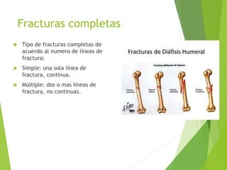 Fracturas completas
 Tipo de fracturas completas de
acuerdo al numero de líneas de
fractura:
 Simple: una sola línea de
fractura, continua.
 Múltiple: dos o mas líneas de
fractura, no continuas.
 