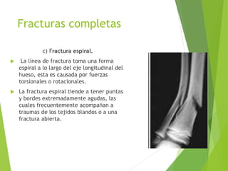 Fracturas completas
c) Fractura espiral.
 La línea de fractura toma una forma
espiral a lo largo del eje longitudinal del
hueso, esta es causada por fuerzas
torsionales o rotacionales.
 La fractura espiral tiende a tener puntas
y bordes extremadamente agudas, las
cuales frecuentemente acompañan a
traumas de los tejidos blandos o a una
fractura abierta.
 