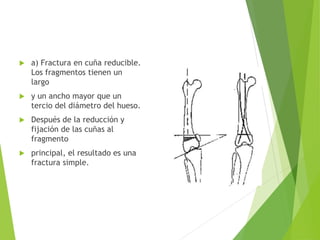  a) Fractura en cuña reducible.
Los fragmentos tienen un
largo
 y un ancho mayor que un
tercio del diámetro del hueso.
 Después de la reducción y
fijación de las cuñas al
fragmento
 principal, el resultado es una
fractura simple.
 