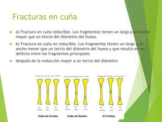Fracturas en cuña
 a) Fractura en cuña reducible. Los fragmentos tienen un largo y un ancho
mayor que un tercio del diámetro del hueso.
 b) Fractura en cuña no reducible. Los fragmentos tienen un largo y un
ancho menor que un tercio del diámetro del hueso y que resulta en un
defecto entre los fragmentos principales
 después de la reducción mayor a un tercio del diámetro
 