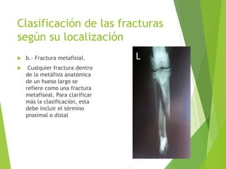 Clasificación de las fracturas
según su localización
 b.- Fractura metafisial.
 Cualquier fractura dentro
de la metáfisis anatómica
de un hueso largo se
refiere como una fractura
metafiseal. Para clarificar
más la clasificación, esta
debe incluir el término
proximal o distal
 