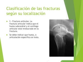 Clasificación de las fracturas
según su localización
 f.- Fractura articular. La
fractura articular indica que el
hueso subcondral y el cartílago
articular está involucrado en la
fractura.
 Se debe indicar que hueso, o
articulación específica se trata.
 