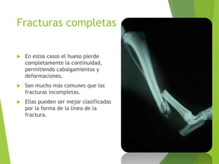 Fracturas completas
 En estos casos el hueso pierde
completamente la continuidad,
permitiendo cabalgamientos y
deformaciones.
 Son mucho más comunes que las
fracturas incompletas.
 Ellas pueden ser mejor clasificadas
por la forma de la línea de la
fractura.
 