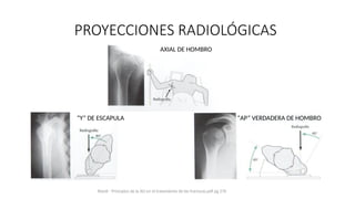 Comprehensive Overview of Proximal and Diaphyseal Humerus Fractures ...