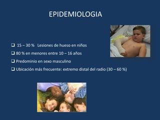 EPIDEMIOLOGIA


 15 – 30 % Lesiones de hueso en niños
 80 % en menores entre 10 – 16 años
 Predominio en sexo masculino
 Ubicación más frecuente: extremo distal del radio (30 – 60 %)
 