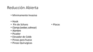 Reducción Abierta
• Minimamente Invasiva
• Hook
• Pin de Schanz
• Clamps(weber,colinear)
• Alambre
• Picador
• Elevador de Cobb
• Pinzas para hueso
• Pinzas Quirurgicas
• Placas
 