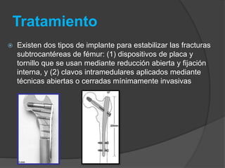 Tratamiento 
 Existen dos tipos de implante para estabilizar las fracturas 
subtrocantéreas de fémur: (1) dispositivos de placa y 
tornillo que se usan mediante reducción abierta y fijación 
interna, y (2) clavos intramedulares aplicados mediante 
técnicas abiertas o cerradas mínimamente invasivas 
 