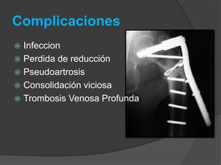 Complicaciones 
 Infeccion 
 Perdida de reducción 
 Pseudoartrosis 
 Consolidación viciosa 
 Trombosis Venosa Profunda 
 