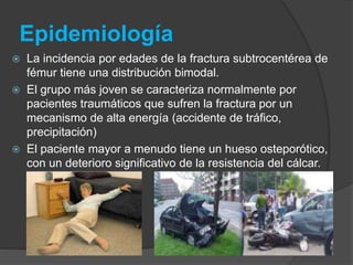 Epidemiología 
 La incidencia por edades de la fractura subtrocentérea de 
fémur tiene una distribución bimodal. 
 El grupo más joven se caracteriza normalmente por 
pacientes traumáticos que sufren la fractura por un 
mecanismo de alta energía (accidente de tráfico, 
precipitación) 
 El paciente mayor a menudo tiene un hueso osteporótico, 
con un deterioro significativo de la resistencia del cálcar. 
 