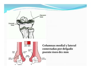 Columnas medial y lateral
conectadas por delgado
puente óseo de1 mm
 