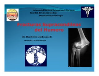 Fracturas Supracondileas
       del Humero
 Dr. Humberto Maldonado R.
  ortopedia y Traumatología
 