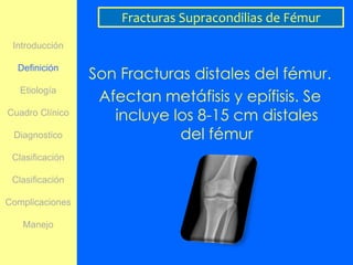 Fracturas Supracondilias de Fémur
 Introducción


                 Son Fracturas distales del fémur.
  Definición


                  Afectan metáfisis y epífisis. Se
   Etiología

Cuadro Clínico
                    incluye los 8-15 cm distales
 Diagnostico                 del fémur
 Clasificación

 Clasificación

Complicaciones

   Manejo
 