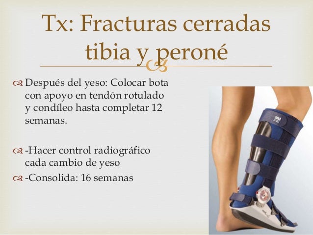Fracturas de Tibia y peroné