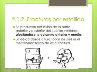 2.1.2. Fracturas por estallido
 Se producen por lesión de la parte
anterior y posterior del cuerpo vertebral
afectándose la columna anterior y media.
 La caída desde altura sobre los pies es el
mecanismo típico de esta fractura.
 
